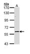 Elongator Acetyltransferase Complex Subunit 3 antibody, LS-B4860, Lifespan Biosciences, Western Blot image 