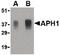 Aph-1 Homolog A, Gamma-Secretase Subunit antibody, LS-B1328, Lifespan Biosciences, Western Blot image 