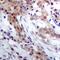 S100 Calcium Binding Protein A4 antibody, abx142210, Abbexa, Western Blot image 