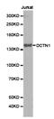 Dynactin Subunit 1 antibody, LS-C192753, Lifespan Biosciences, Western Blot image 