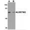 Leucine Rich Repeat Transmembrane Neuronal 2 antibody, MBS150605, MyBioSource, Western Blot image 