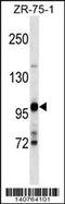 Unc-51 Like Autophagy Activating Kinase 2 antibody, TA324665, Origene, Western Blot image 