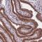 Coiled-Coil Domain Containing 113 antibody, NBP2-14444, Novus Biologicals, Immunohistochemistry paraffin image 