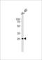 FcRIIIb antibody, LS-B15673, Lifespan Biosciences, Western Blot image 