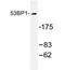 p53BP1 antibody, AP20288PU-N, Origene, Western Blot image 