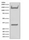 Neurotrophic Receptor Tyrosine Kinase 1 antibody, M00706, Boster Biological Technology, Western Blot image 