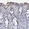 Sodium/hydrogen exchanger 3 antibody, NBP1-82574, Novus Biologicals, Immunohistochemistry frozen image 