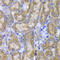 SPARC antibody, A1615, ABclonal Technology, Immunohistochemistry paraffin image 