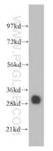 Tropomyosin 4 antibody, 13741-1-AP, Proteintech Group, Western Blot image 
