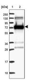 Synaptotagmin-like protein 1 antibody, PA5-58126, Invitrogen Antibodies, Western Blot image 