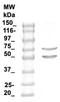 Microtubule Associated Protein Tau antibody, TA354881, Origene, Western Blot image 