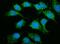 Mitochondrial Ribosomal Protein S25 antibody, A14080-3, Boster Biological Technology, Immunofluorescence image 