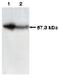 Chaperonin Containing TCP1 Subunit 2 antibody, AM05385PU-N, Origene, Western Blot image 