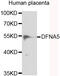 Gasdermin E antibody, abx006488, Abbexa, Western Blot image 
