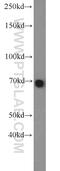 T-Box 18 antibody, 23237-1-AP, Proteintech Group, Western Blot image 