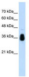 Makorin Ring Finger Protein 1 antibody, TA329834, Origene, Western Blot image 