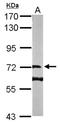 DENN Domain Containing 1B antibody, NBP1-32715, Novus Biologicals, Western Blot image 