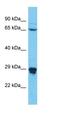 NEDD4 Binding Protein 2 Like 1 antibody, orb327031, Biorbyt, Western Blot image 