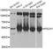Fascin Actin-Bundling Protein 1 antibody, A13355, ABclonal Technology, Western Blot image 