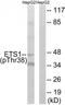ETS Proto-Oncogene 1, Transcription Factor antibody, TA315277, Origene, Western Blot image 