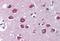 Myocyte Enhancer Factor 2C antibody, orb89015, Biorbyt, Immunohistochemistry paraffin image 