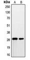 Prostate Stem Cell Antigen antibody, LS-C353033, Lifespan Biosciences, Western Blot image 