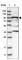 Ribosomal RNA Processing 1B antibody, HPA020324, Atlas Antibodies, Western Blot image 