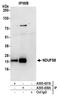 NADH dehydrogenase [ubiquinone] iron-sulfur protein 8, mitochondrial antibody, A305-438A, Bethyl Labs, Immunoprecipitation image 