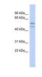 Spermatogenesis And Oogenesis Specific Basic Helix-Loop-Helix 2 antibody, NBP1-80339, Novus Biologicals, Western Blot image 