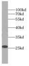 D4 antibody, FNab00556, FineTest, Western Blot image 