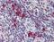 Linker For Activation Of T Cells Family Member 2 antibody, orb89105, Biorbyt, Immunohistochemistry paraffin image 