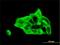 Desmocollin 3 antibody, H00001825-M01, Novus Biologicals, Immunocytochemistry image 