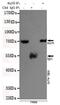 X-Ray Repair Cross Complementing 6 antibody, GTX66844, GeneTex, Immunoprecipitation image 