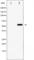 Forkhead Box O4 antibody, abx010799, Abbexa, Western Blot image 