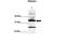 Pyruvate Dehydrogenase E1 Alpha 1 Subunit antibody, ARP48137_T100, Aviva Systems Biology, Western Blot image 