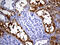 Phytanoyl-CoA Dioxygenase Domain Containing 1 antibody, M12964, Boster Biological Technology, Immunohistochemistry paraffin image 
