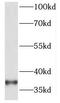 Homeobox A11 antibody, FNab03973, FineTest, Western Blot image 