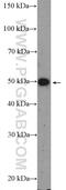 Lecithin retinol acyltransferase antibody, 12815-1-AP, Proteintech Group, Western Blot image 