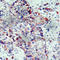 Mitogen-Activated Protein Kinase Kinase 4 antibody, AP0390, ABclonal Technology, Immunohistochemistry paraffin image 