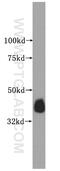 Cartilage Associated Protein antibody, 15724-1-AP, Proteintech Group, Western Blot image 