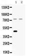 Complement factor I antibody, PB9935, Boster Biological Technology, Western Blot image 