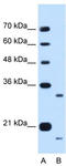 Cell Cycle Progression 1 antibody, TA339430, Origene, Western Blot image 