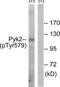 Protein Tyrosine Kinase 2 Beta antibody, TA312568, Origene, Western Blot image 