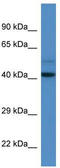 DDB1- and CUL4-associated factor 7 antibody, TA340080, Origene, Western Blot image 