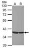 ETS Transcription Factor ELK3 antibody, PA5-30235, Invitrogen Antibodies, Western Blot image 