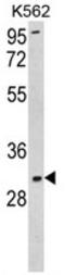 Superoxide Dismutase 3 antibody, AP17757PU-N, Origene, Western Blot image 