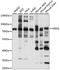 Menin 1 antibody, LS-C750261, Lifespan Biosciences, Western Blot image 