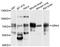 G Protein-Coupled Receptor Kinase 4 antibody, STJ112407, St John