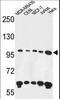 Ankyrin Repeat And FYVE Domain Containing 1 antibody, LS-C156338, Lifespan Biosciences, Western Blot image 