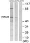 Tripartite Motif Containing 38 antibody, PA5-38516, Invitrogen Antibodies, Western Blot image 